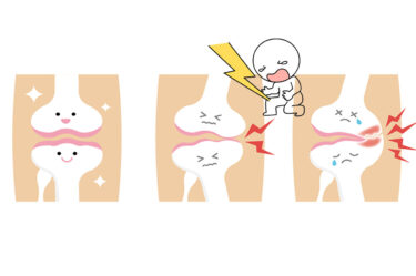 膝が痛い！今からでもできる予防と対策