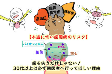 【本当に怖い歯周病のリスク】歯を失うだけじゃない！30代以上は必ず歯医者へ行ってほしい理由